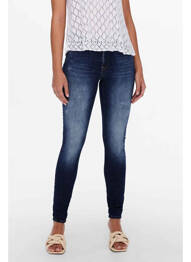 Blugi skinny albastru ONLY femeie